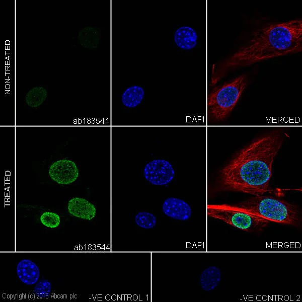 Immunocytochemistry/ Immunofluorescence - Anti-p53 (acetyl K370) antibody [EPR17496] - BSA and Azide free (AB240273)