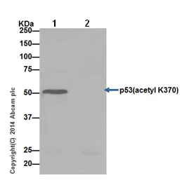 Immunoprecipitation - Anti-p53 (acetyl K370) antibody [EPR17496] - BSA and Azide free (AB240273)