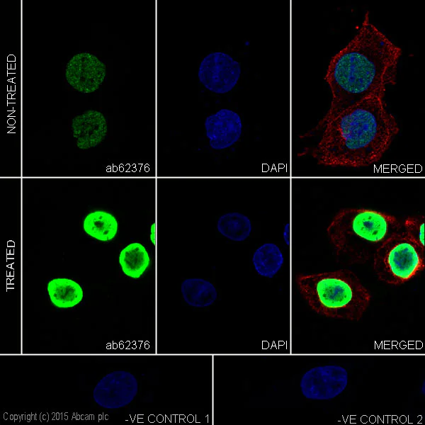 Immunocytochemistry/ Immunofluorescence - Anti-p53 (acetyl K373) antibody [EP356(2)AY] (AB62376)