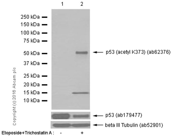 Western blot - Anti-p53 (acetyl K373) antibody [EP356(2)AY] (AB62376), expandable thumbnail