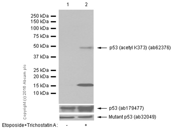 Western blot - Anti-p53 (acetyl K373) antibody [EP356(2)AY] (AB62376), expandable thumbnail