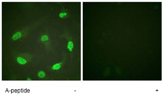 Immunocytochemistry/ Immunofluorescence - Anti-p53 (acetyl K381) antibody (AB61241)