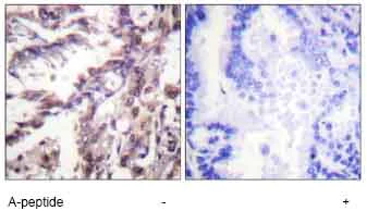 Immunohistochemistry (Formalin/PFA-fixed paraffin-embedded sections) - Anti-p53 (acetyl K381) antibody (AB61241)