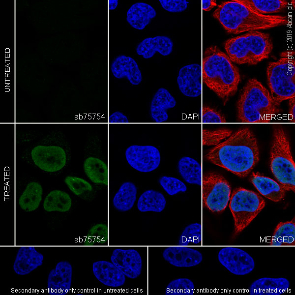 Immunocytochemistry/ Immunofluorescence - Anti-p53 (acetyl K382) antibody [EPR358(2)] (AB75754), expandable thumbnail
