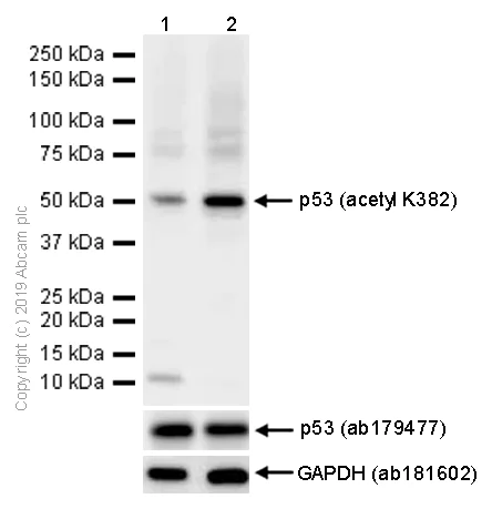 Western blot - Anti-p53 (acetyl K382) antibody [EPR358(2)] (AB75754)