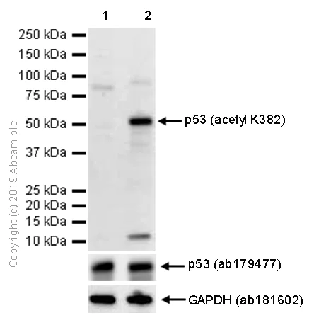 Western blot - Anti-p53 (acetyl K382) antibody [EPR358(2)] - BSA and Azide free (AB219727)