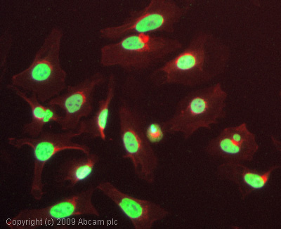 Immunocytochemistry/ Immunofluorescence - Anti-p53 (acetyl K386) antibody (AB52172), expandable thumbnail