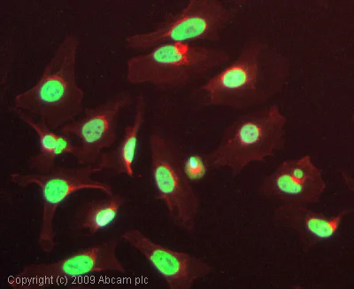 Immunocytochemistry/ Immunofluorescence - Anti-p53 (acetyl K386) antibody (AB52172)