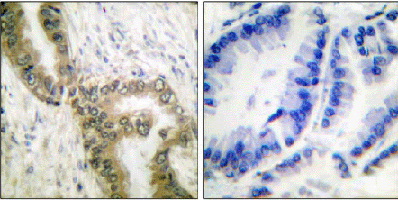Immunohistochemistry (Formalin/PFA-fixed paraffin-embedded sections) - Anti-p53 (acetyl K386) antibody (AB52172), expandable thumbnail