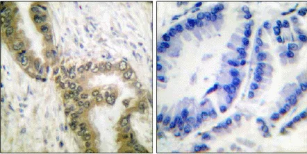 Immunohistochemistry (Formalin/PFA-fixed paraffin-embedded sections) - Anti-p53 (acetyl K386) antibody (AB52172)