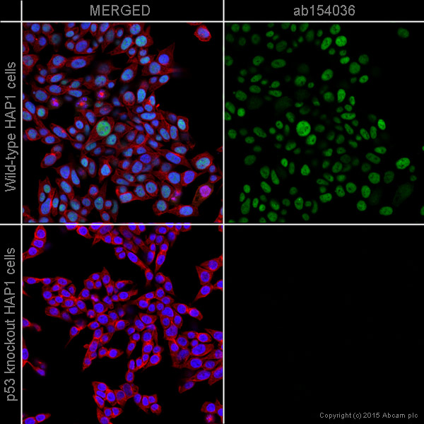 Immunocytochemistry/ Immunofluorescence - Anti-p53 antibody [9D3DE3] (AB154036)