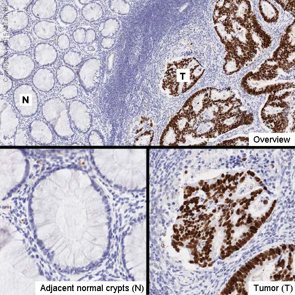 Immunohistochemistry (Formalin/PFA-fixed paraffin-embedded sections) - Anti-p53 antibody [9D3DE3] (AB154036)