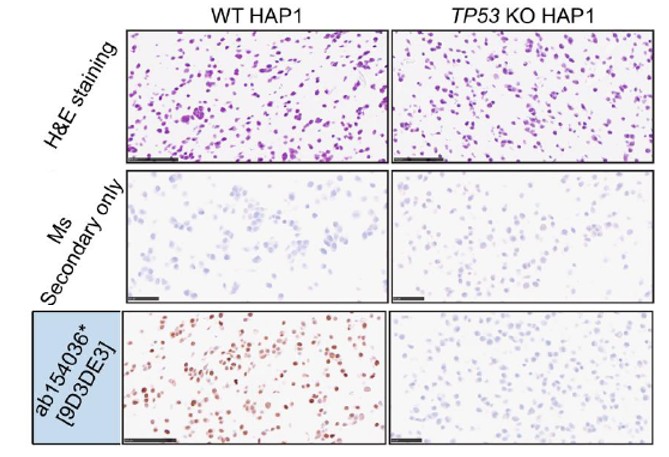 Immunohistochemistry (Formalin/PFA-fixed paraffin-embedded sections) - Anti-p53 antibody [9D3DE3] (AB154036)