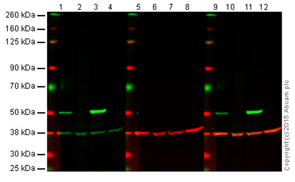 Anti-p53 antibody [9D3DE3]