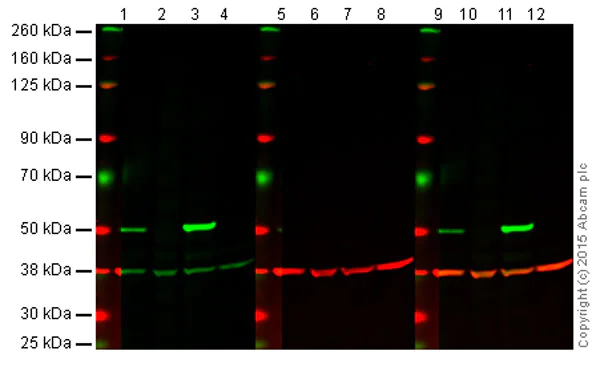 Western blot - Anti-p53 antibody [9D3DE3] (AB154036)