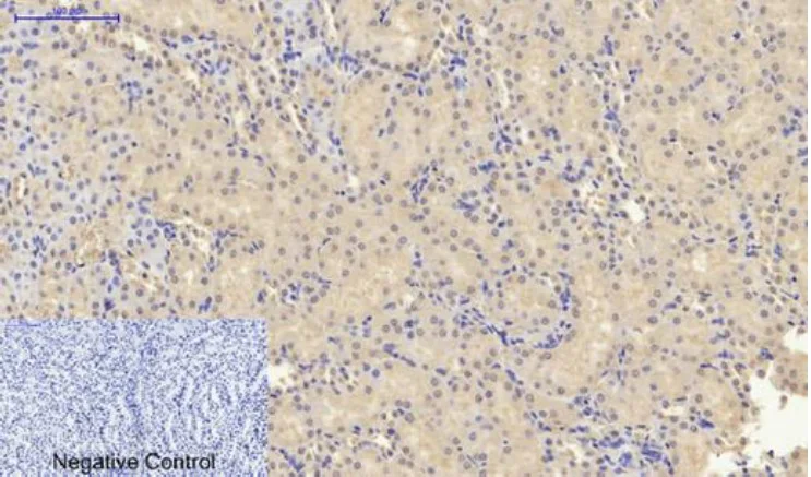 Immunohistochemistry (Formalin/PFA-fixed paraffin-embedded sections) - Anti-p53 antibody (AB131442)