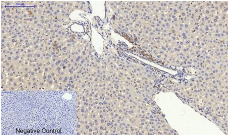 Immunohistochemistry (Formalin/PFA-fixed paraffin-embedded sections) - Anti-p53 antibody (AB131442)