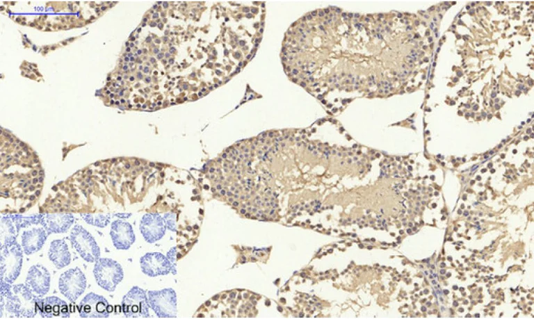 Immunohistochemistry (Formalin/PFA-fixed paraffin-embedded sections) - Anti-p53 antibody (AB131442)