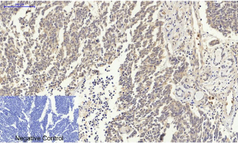 Immunohistochemistry (Formalin/PFA-fixed paraffin-embedded sections) - Anti-p53 antibody (AB131442)