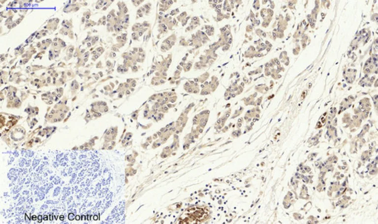 Immunohistochemistry (Formalin/PFA-fixed paraffin-embedded sections) - Anti-p53 antibody (AB131442)