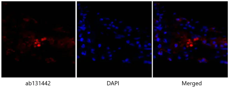 Immunohistochemistry (Formalin/PFA-fixed paraffin-embedded sections) - Anti-p53 antibody (AB131442)