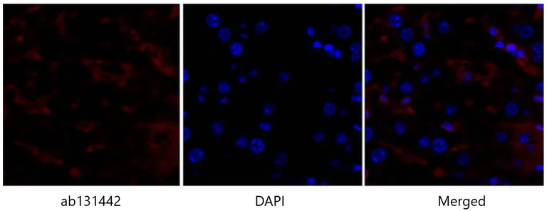 Immunohistochemistry (Formalin/PFA-fixed paraffin-embedded sections) - Anti-p53 antibody (AB131442)