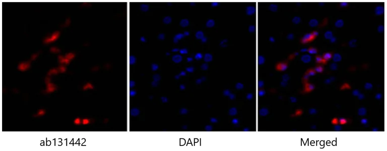 Immunohistochemistry (Formalin/PFA-fixed paraffin-embedded sections) - Anti-p53 antibody (AB131442)