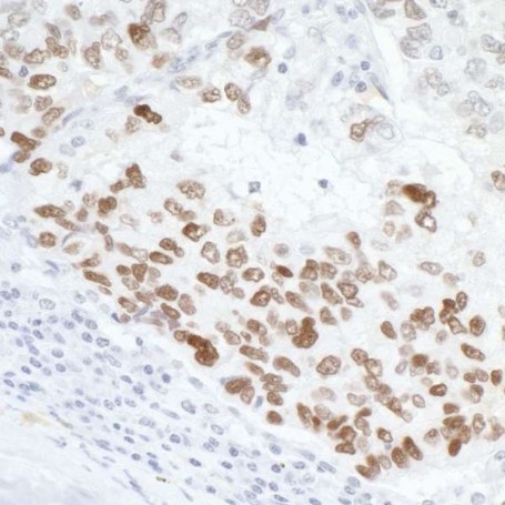 Immunohistochemistry (Formalin/PFA-fixed paraffin-embedded sections) - Anti-p53 antibody (AB17990)
