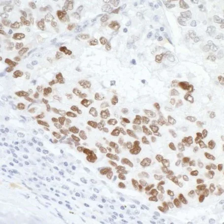 Immunohistochemistry (Formalin/PFA-fixed paraffin-embedded sections) - Anti-p53 antibody (AB17990)