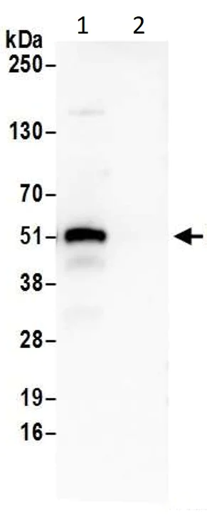 Immunoprecipitation - Anti-p53 antibody (AB17990)
