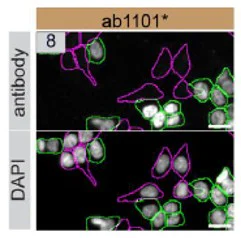 Immunocytochemistry/ Immunofluorescence - Anti-p53 antibody [DO-1] (AB1101)