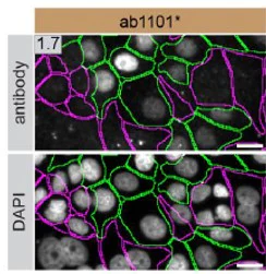 Immunocytochemistry/ Immunofluorescence - Anti-p53 antibody [DO-1] (AB1101)