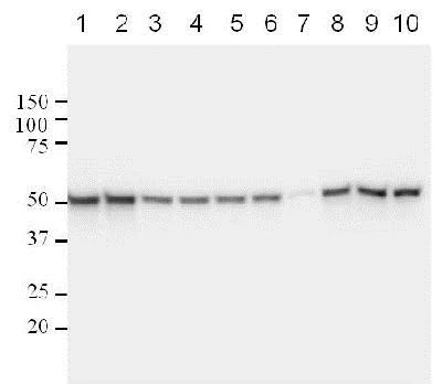 Western blot - Anti-p53 antibody [DO-1] (AB1101)