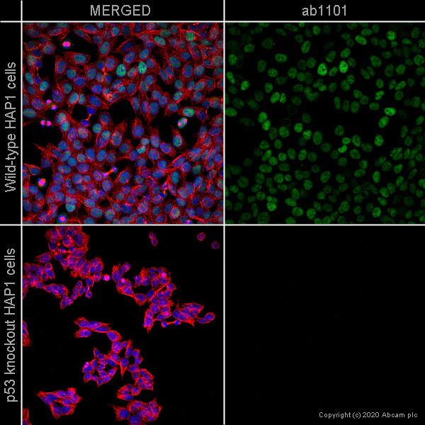 Immunocytochemistry/ Immunofluorescence - Anti-p53 antibody [DO-1] - BSA and Azide free (AB237976)