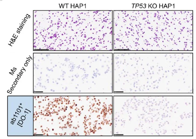 Immunohistochemistry (Formalin/PFA-fixed paraffin-embedded sections) - Anti-p53 antibody [DO-1] - BSA and Azide free (AB237976)