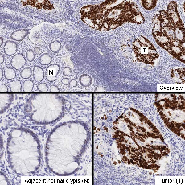 Immunohistochemistry (Formalin/PFA-fixed paraffin-embedded sections) - Anti-p53 antibody [DO-1] - BSA and Azide free (AB237976)