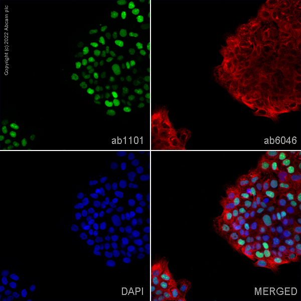 Immunocytochemistry/ Immunofluorescence - Anti-p53 antibody [DO-1] - ChIP Grade (ab1101), expandable thumbnail