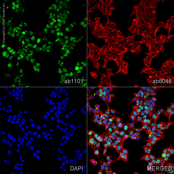 Immunocytochemistry/ Immunofluorescence - Anti-p53 antibody [DO-1] - ChIP Grade (ab1101), expandable thumbnail