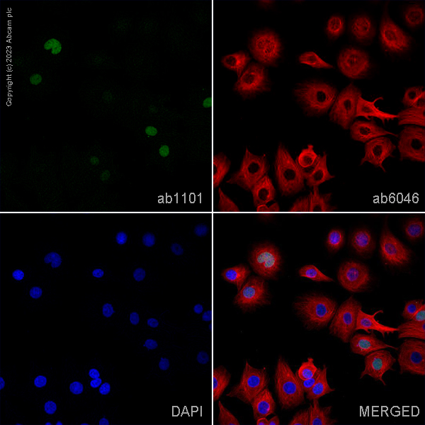 Immunocytochemistry/ Immunofluorescence - Anti-p53 antibody [DO-1] - ChIP Grade (ab1101), expandable thumbnail