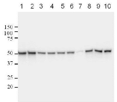 Western blot - Anti-p53 antibody [DO-1] - ChIP Grade (AB1101), expandable thumbnail