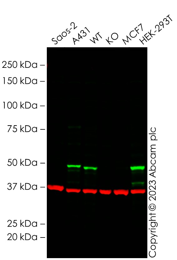 Western blot - Anti-p53 antibody [DO-1] - ChIP Grade (ab1101), expandable thumbnail