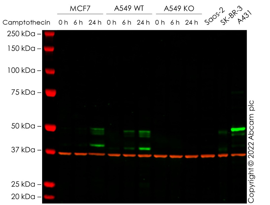 Western blot - Anti-p53 antibody [DO-1] - ChIP Grade (ab1101), expandable thumbnail