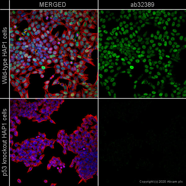 Immunocytochemistry/ Immunofluorescence - Anti-p53 antibody [E26] (AB32389), expandable thumbnail