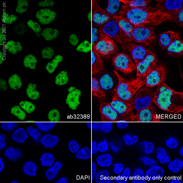 Immunocytochemistry/ Immunofluorescence - Anti-p53 antibody [E26] (ab32389), expandable thumbnail