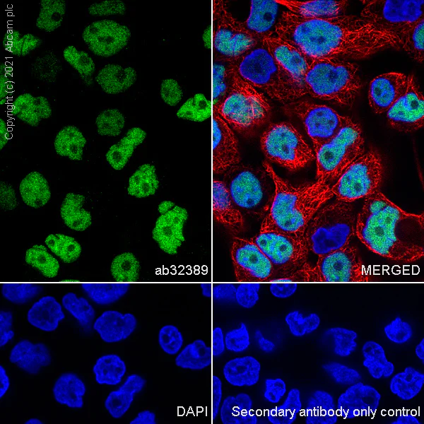 Immunocytochemistry/ Immunofluorescence - Anti-p53 antibody [E26] (AB32389)