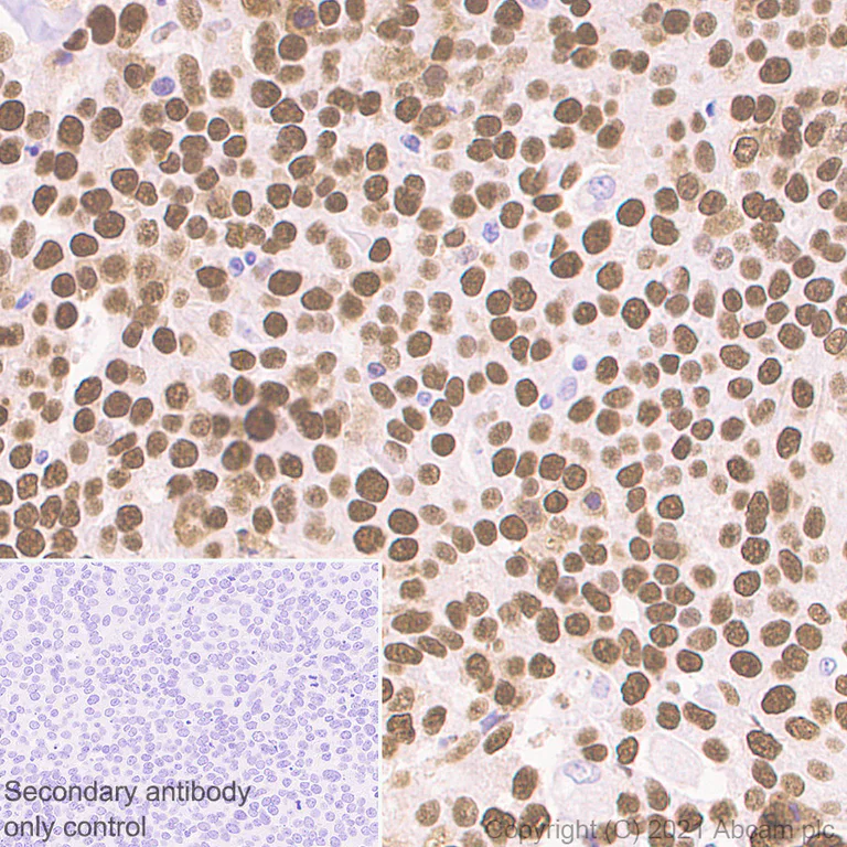 Immunohistochemistry (Formalin/PFA-fixed paraffin-embedded sections) - Anti-p53 antibody [E26] (AB32389)