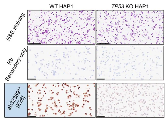 Immunohistochemistry (Formalin/PFA-fixed paraffin-embedded sections) - Anti-p53 antibody [E26] (AB32389)