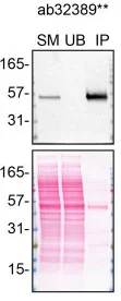 Immunoprecipitation - Anti-p53 antibody [E26] (AB32389)