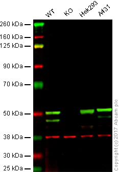 Western blot - Anti-p53 antibody [E26] (AB32389)