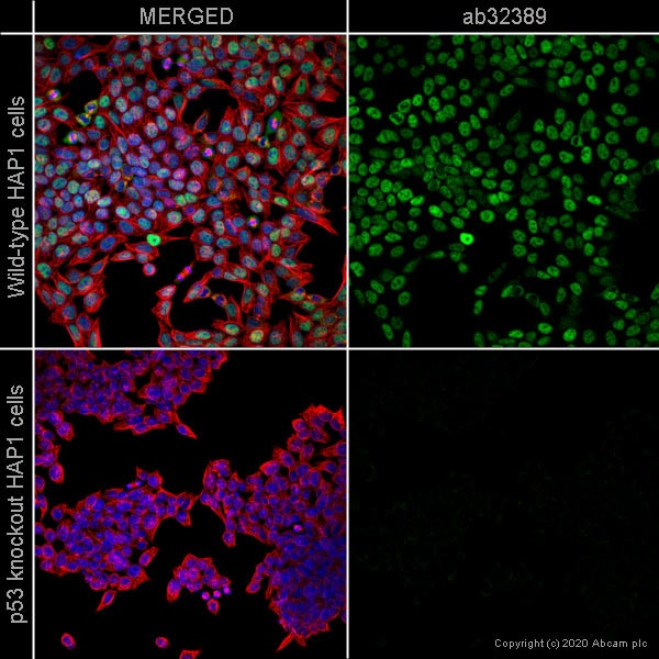 Immunocytochemistry/ Immunofluorescence - Anti-p53 antibody [E26] - BSA and Azide free (AB225531), expandable thumbnail